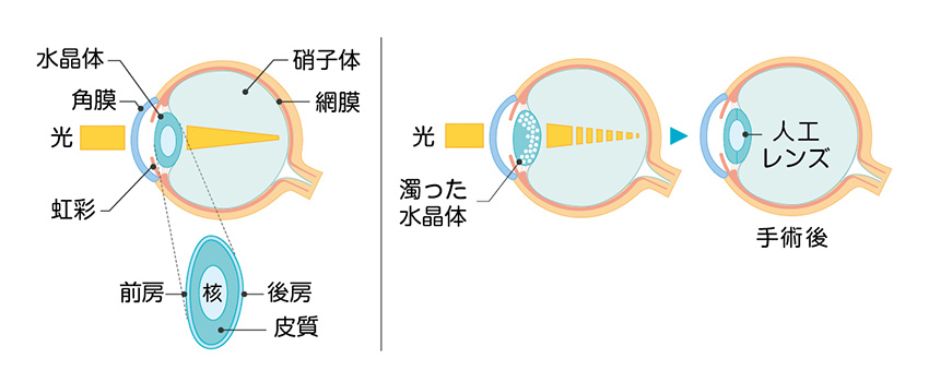 治療方法