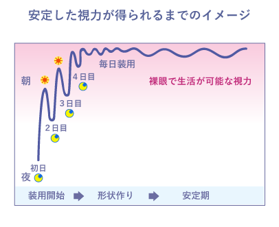 安定した視力が得られるまでのイメージ